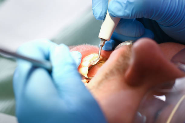 Best Weekend Emergency Dental Services in Valparaiso, IN