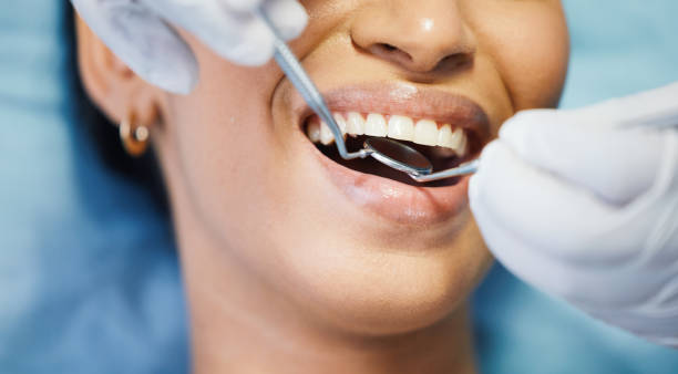 Best Emergency Denture Repair in Valparaiso, IN